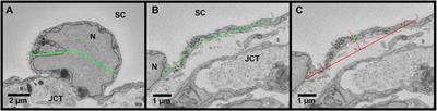 Schlemm’s Canal Endothelium Cellular Connectivity in Giant Vacuole and Pore Formation in Different Flow-type Areas: A Serial Block-Face Scanning Electron Microscopy Study